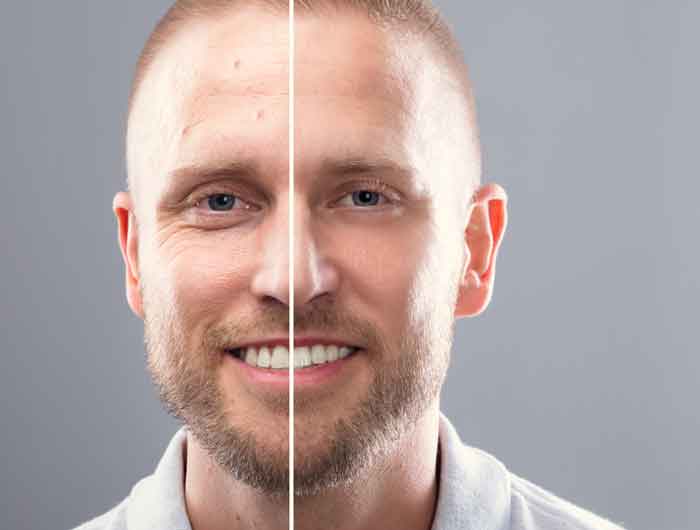 Unser Face Lifter - der Skin Cell Tronic